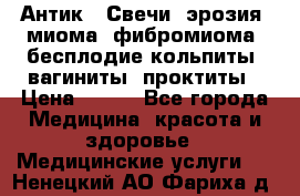 Антик.  Свечи (эрозия, миома, фибромиома, бесплодие,кольпиты, вагиниты, проктиты › Цена ­ 550 - Все города Медицина, красота и здоровье » Медицинские услуги   . Ненецкий АО,Фариха д.